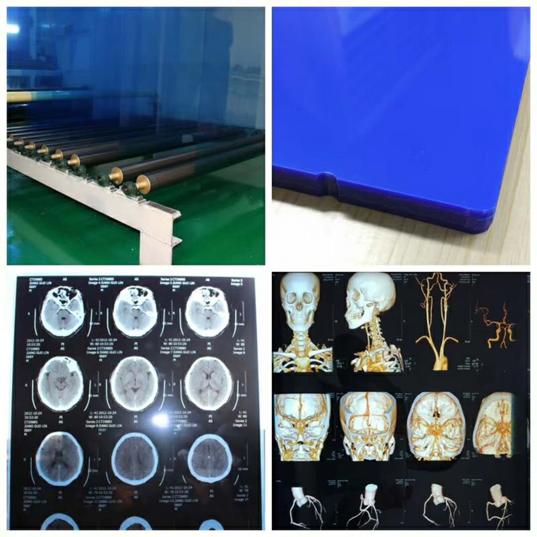 医用胶片干式放射科打印胶片喷墨蓝片牙科骨折DRCR光MR磁共振 - 图2