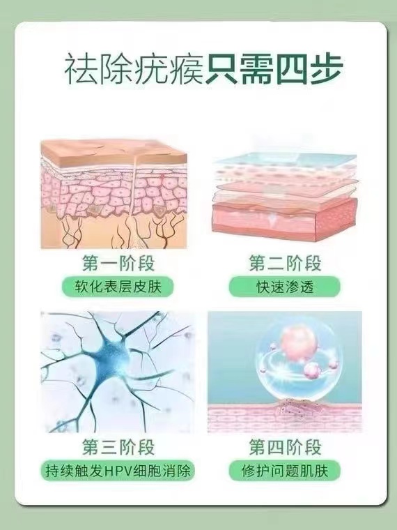 500ml小瓶液氮冷冻去疣猴子扁平疣丝状疣肉疣去除医用克疣液-图3