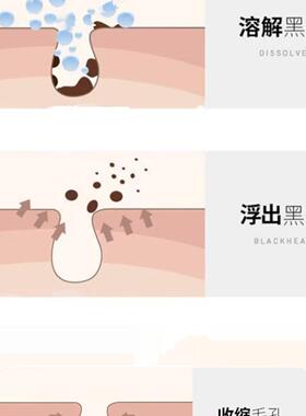 黑头导出液去粉刺螨虫毛孔收缩