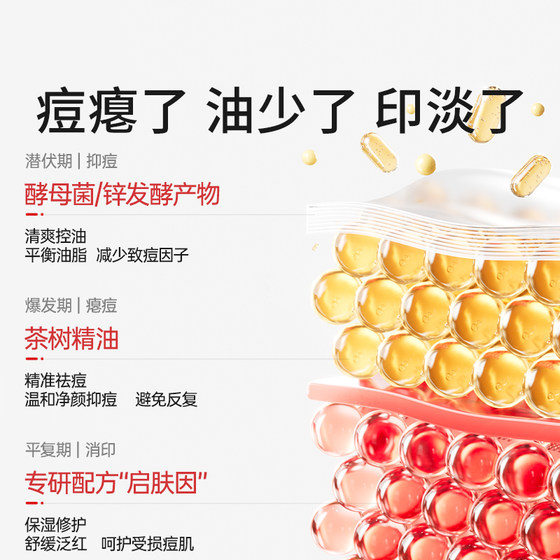 October Crystal Miqi Teenagers Anti-Acne Essence Spot Application Student Party First Aid Adolescent Acne Oil Control Repair