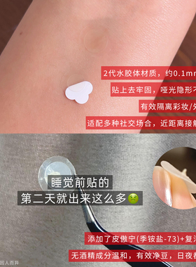 【品牌直供】盾施美痘痘贴