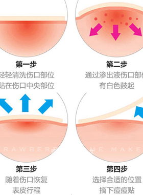 【品牌直供】oliveyoung痘痘贴