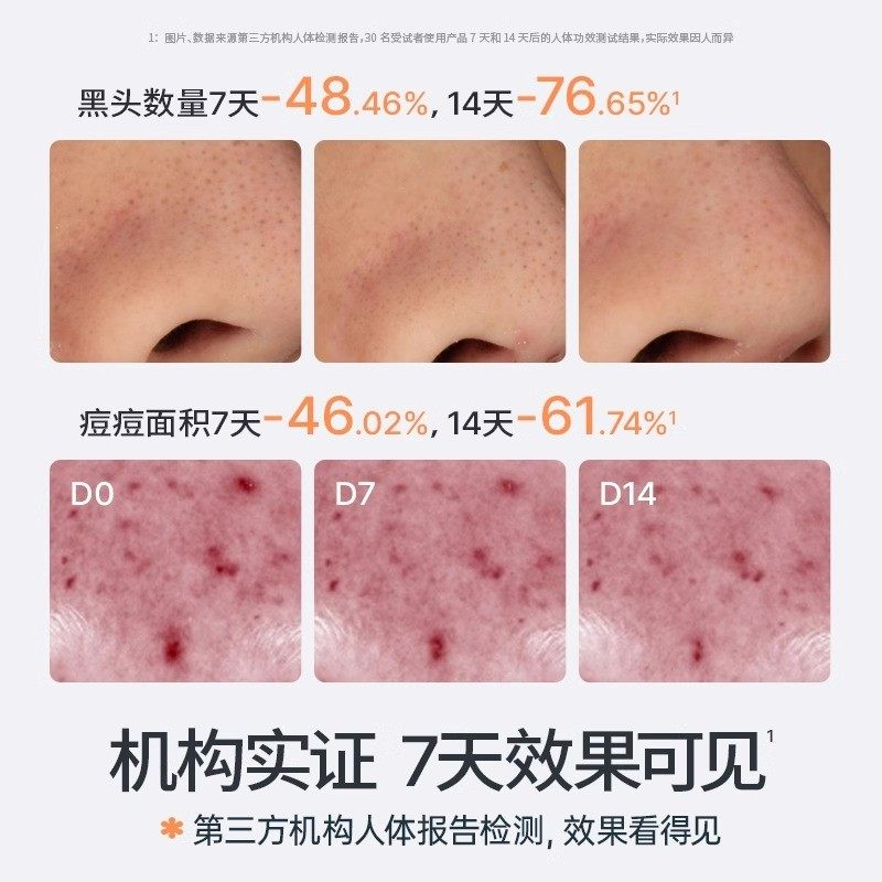 海龟爸爸青少年洗面奶祛痘套装氨基酸男孩女学生控油洁面官方正品,淘宝优惠券,粉丝福利购,淘宝优惠卷