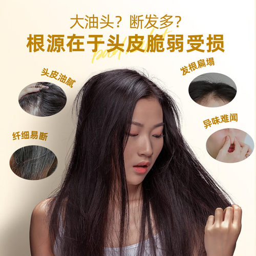 云南白药养元青生姜洗发露控油蓬松强健发根洗发水新老包装随机发 - 图2