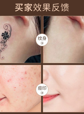 小金管遮瑕膏遮盖斑点痘印痘痘肌强力巨遮瑕纹身男化妆师专用神器