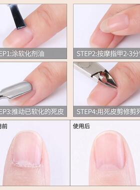 死皮剪美甲店专用修手指甲边缘去角质软化剂钢推护理工具套装全套