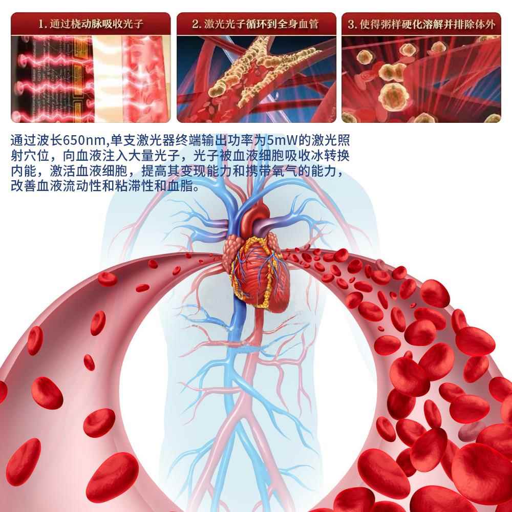 半导体三高激光治疗仪心脑血氧腕表降血粘高血压脂血糖尿病理疗仪