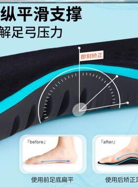 Arch support insoles Flat foot orthopedic insole 矫正鞋垫