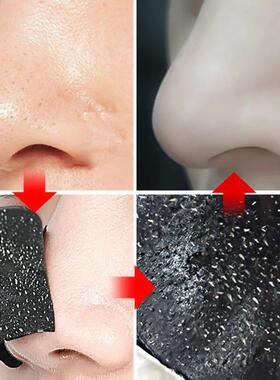102050100 PCS Nose Strips For Blackheads Acne Removal Instan