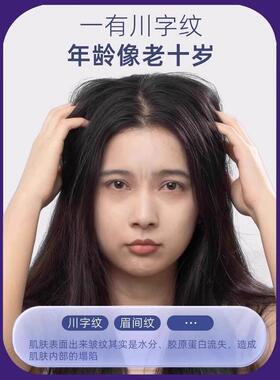 水滴眉间川字纹贴水滴川字纹改善淡化擡头纹额头悬针纹皱眉神器