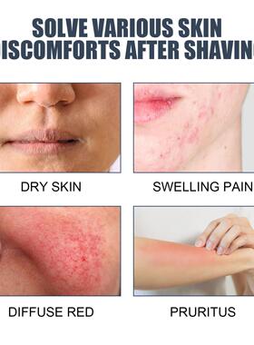 East Moon Post-Shave Balm - Refreshing Men's Facial After-Sh