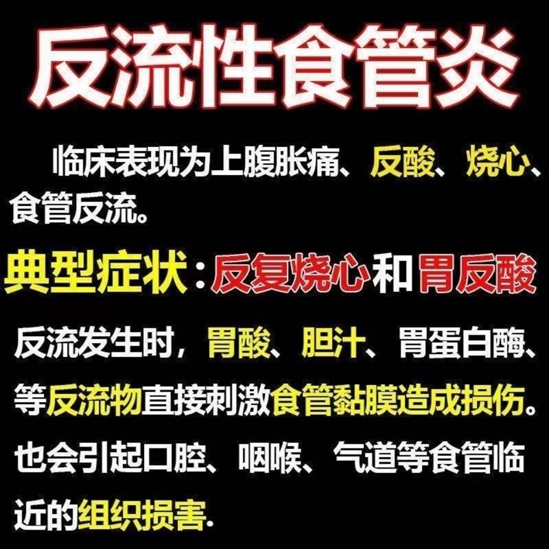 胃食管反流贴治烧心反流性食上腹烧灼感胃痛胸痛干呕肠胃贴-图0