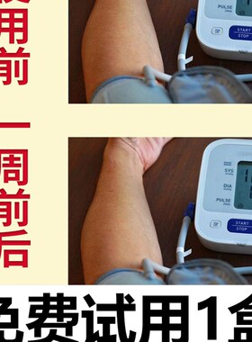 工厂销降压稳压专用神器平压稳压贴缓解头痛头晕S气短胸闷降压专