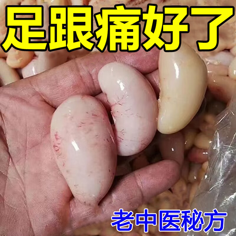 推荐足跟痛神器【一盒就好】跟腱炎筋膜炎足跟骨刺足底脚底板走路 - 图1