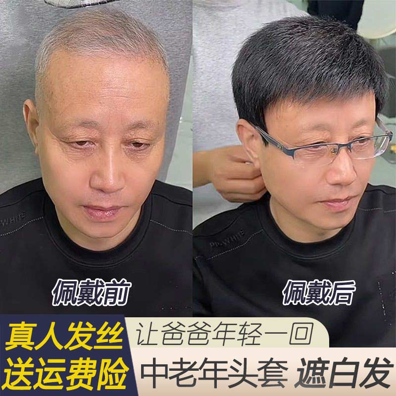 假发男士中老年全真人发头套遮白发秃顶爸爸光头短发Y寸头整顶发 - 图0