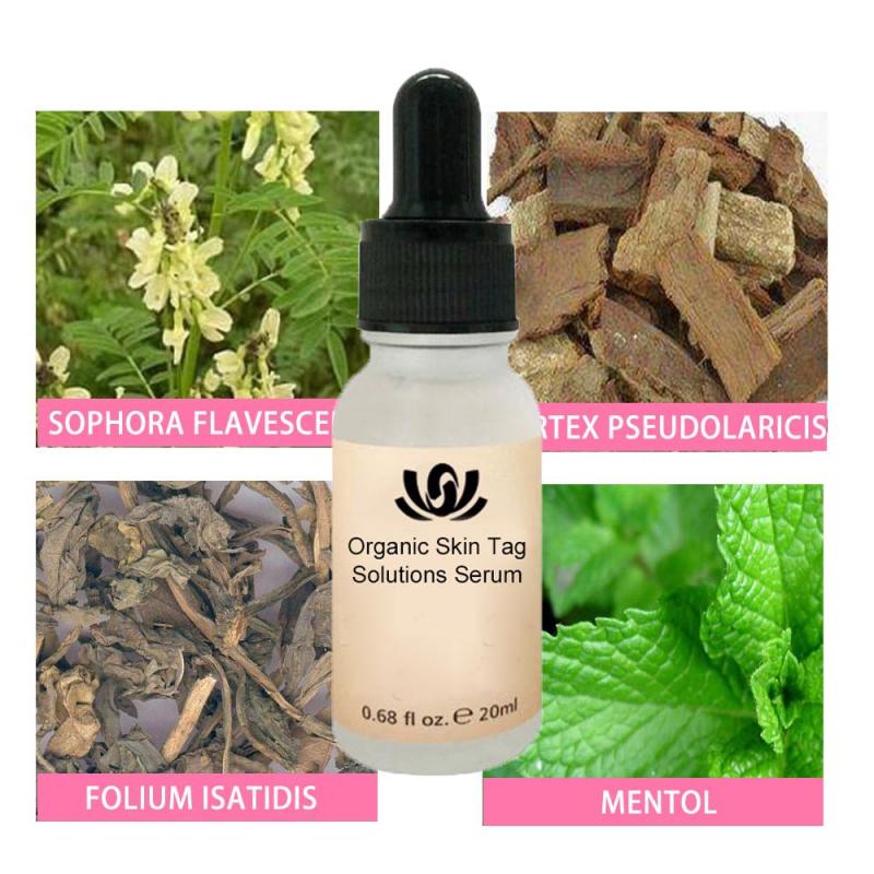 新品Organic Tags Solutions Serum Painless Mole Skin Dark Spo - 图2