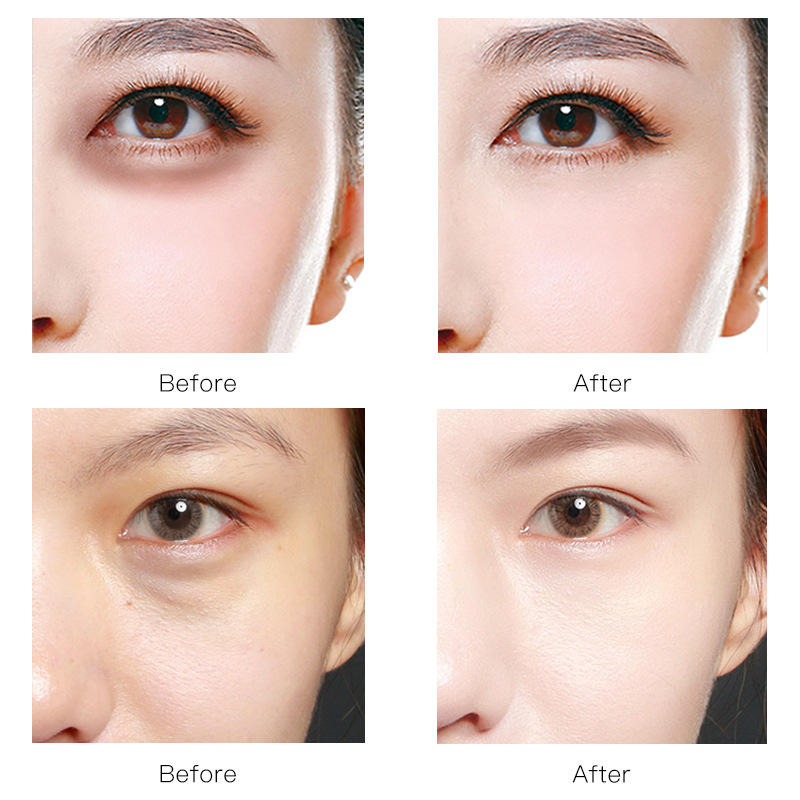 推荐Eye Mask Moisturizing Hyaluronic Acid Eye Patch Skin Car - 图3