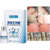 Remove Chicken Eye Footed special patch Old cocoon Cream cured meat Cocoon Toe cocoon Cocoon Footbed Fluid 