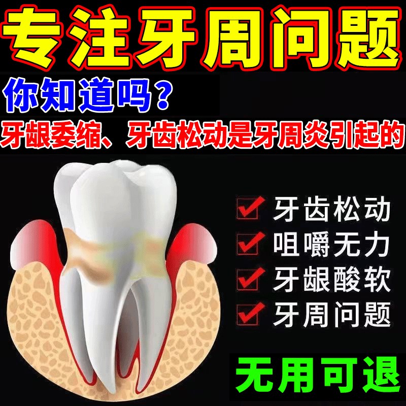 牙牙松不用拔】【齿m松动牙龈萎缩肿痛牙膏动牙酸痛护龈固齿牙晃C - 图1