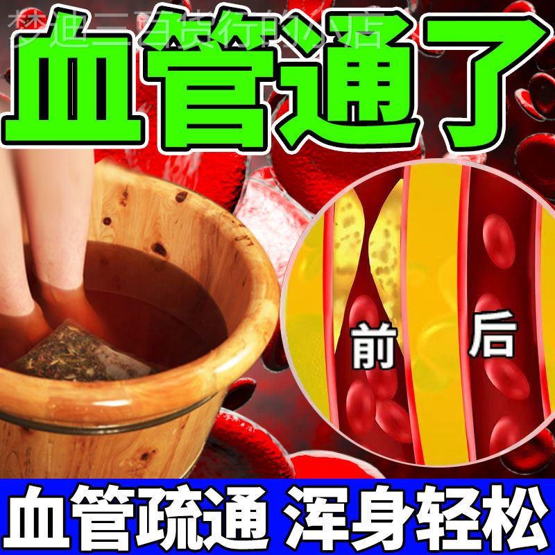 推荐泡脚药包艾草叶足浴包祛寒湿去湿气助睡眠非排毒排体内湿寒泡 - 图0