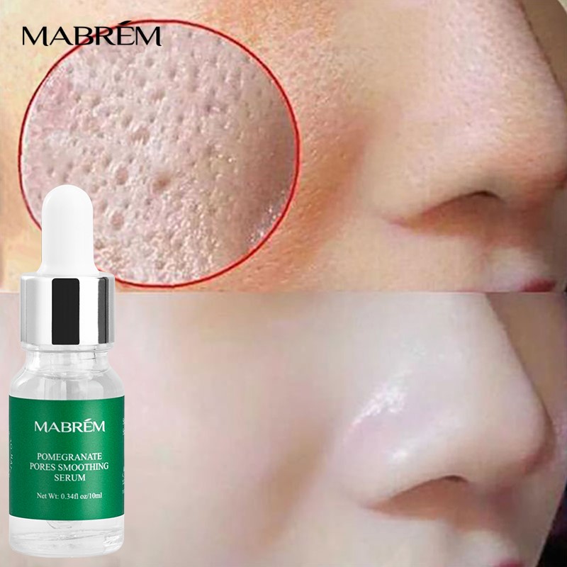 速发Pore Shrinking Serum Essence Pores Treatment Moisturizin - 图1
