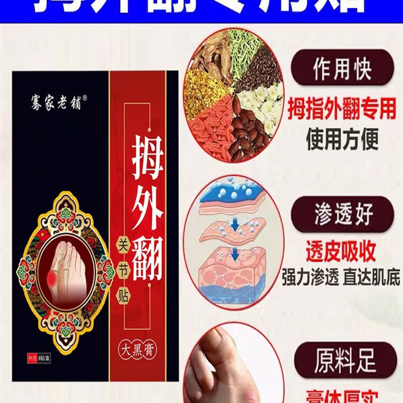 翻神专【买3送用】拇指外翻矫正器大脚骨T脚趾重叠器2贴 - 图0