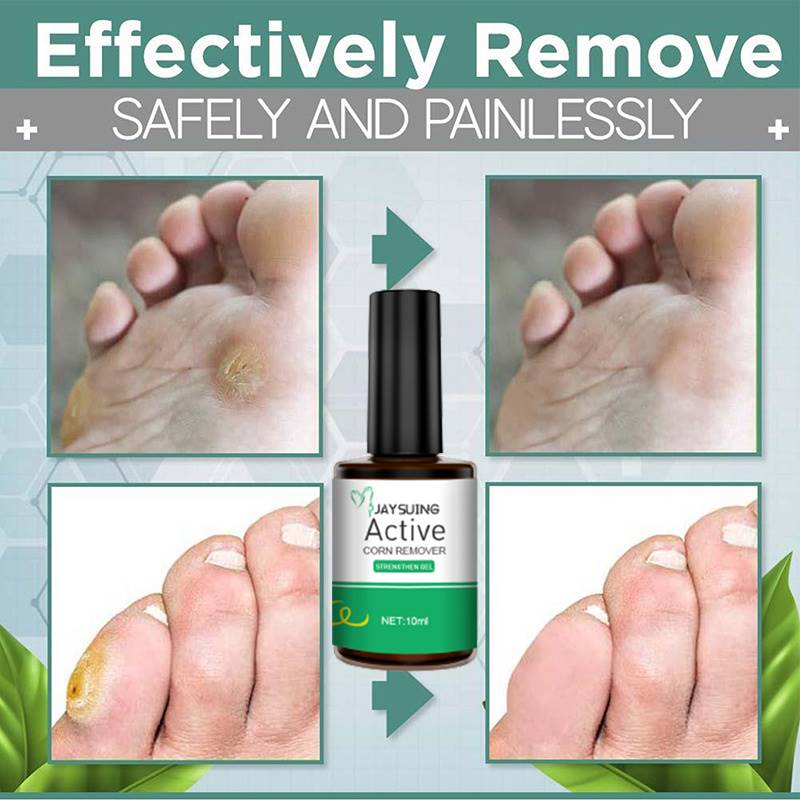 Efoectcively Remove Warts Foot Corn fssence Mild RemEal Corn - 图1