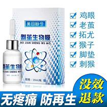 Remove Chicken Eye Footed special patch Old cocoon Cream cured meat Cocoon Toe cocoon Cocoon Footbed Fluid 