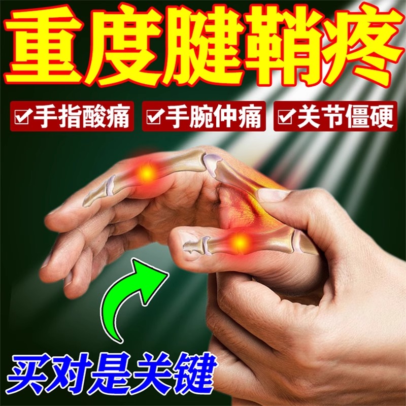 推荐腱鞘消除专用膏药【100%能好】手指弯曲困难大拇指疼痛肿胀鼓 - 图0