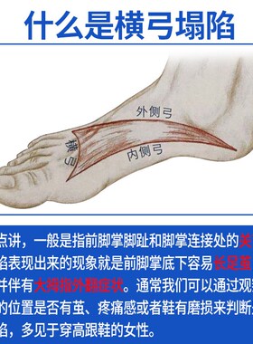 运动健走专用鞋垫拇指外翻减震足弓D支撑脚垫U型跟杯高弹跖骨支撑