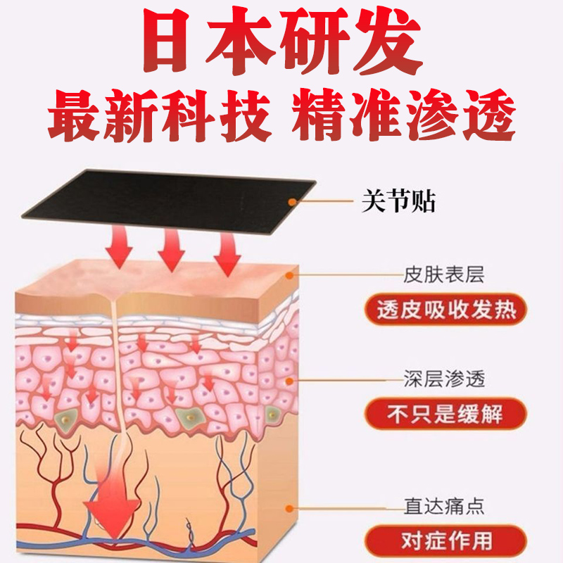 拇指外翻贴母外翻贴膏拇脚趾矫正器大母脚趾外翻药拇外翻矫正神器 - 图1