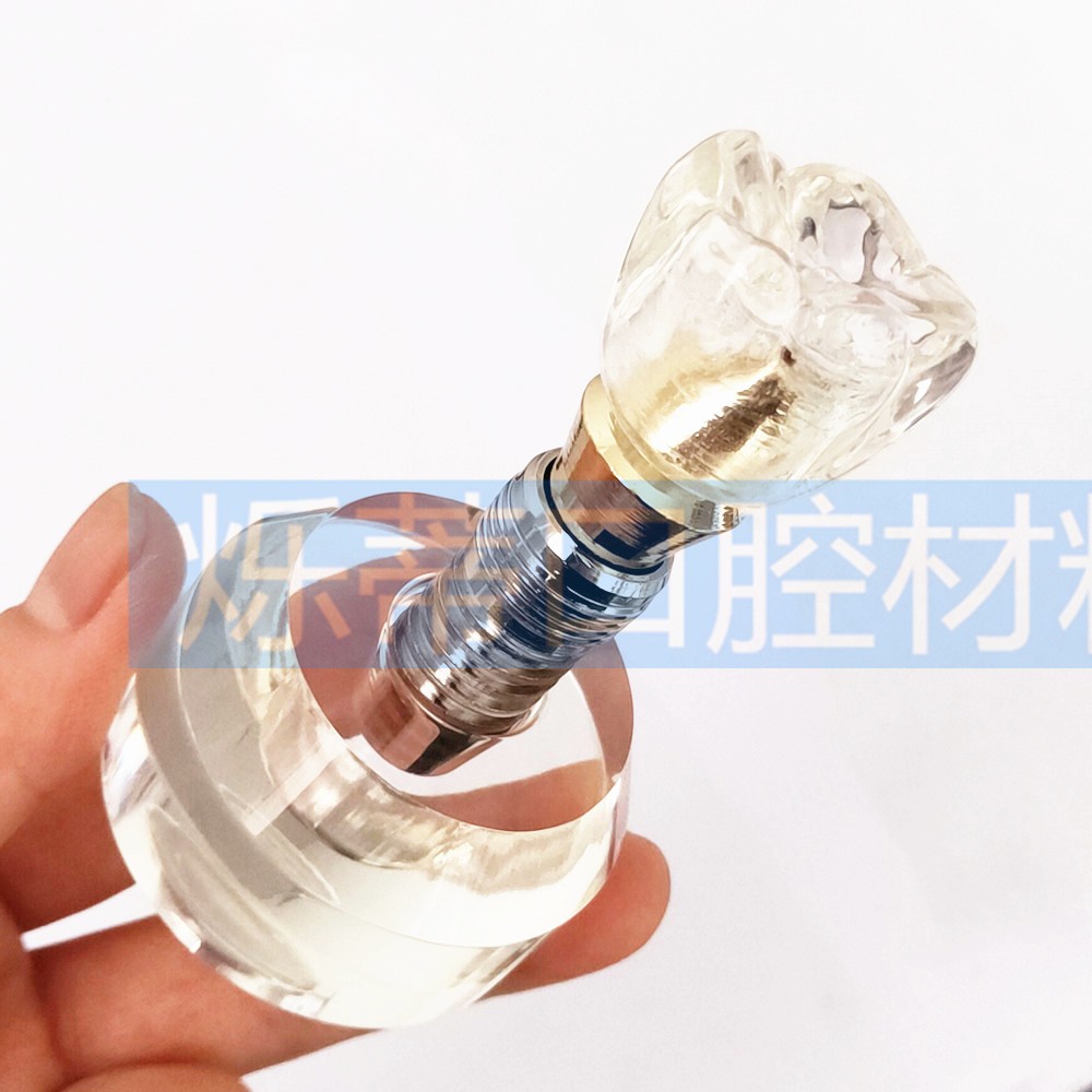 牙科模型牙齿牙模种植修复正畸模型口腔教学医患沟通讲解分析模型 - 图3