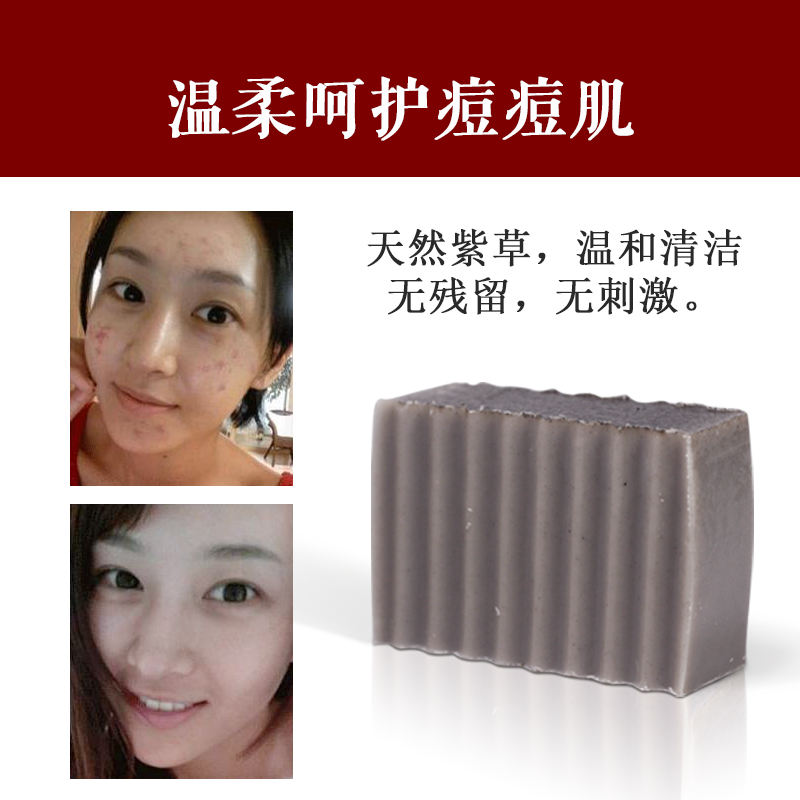 朗朗熊旗舰店朗朗熊紫草手工纯皂天然非祛痘印粉刺去黑头除螨精油洗脸洁面香皂1