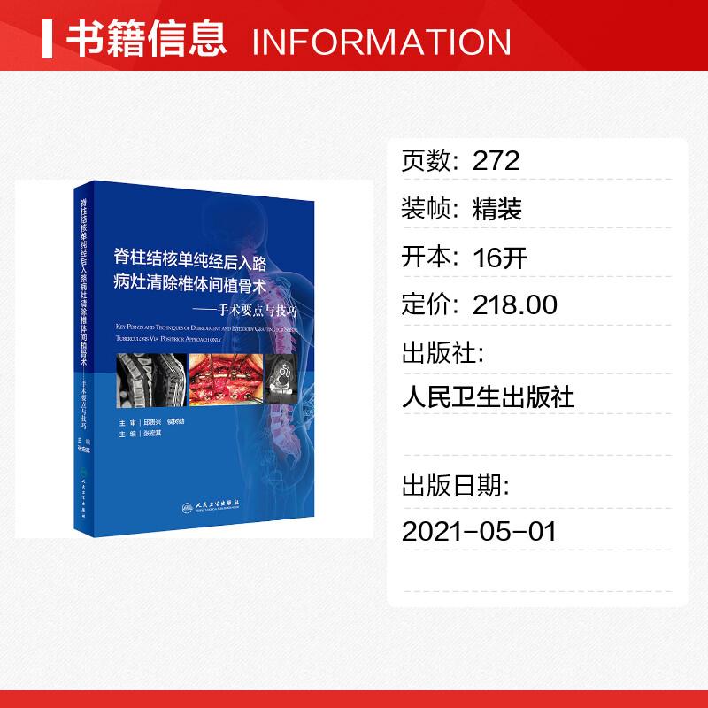 【新华文轩】脊柱结核单纯经后入路病灶清除与椎体间植骨术——手术要点与技巧 正版书籍 新华书店旗舰店文轩官网 人民卫生出版社 - 图0