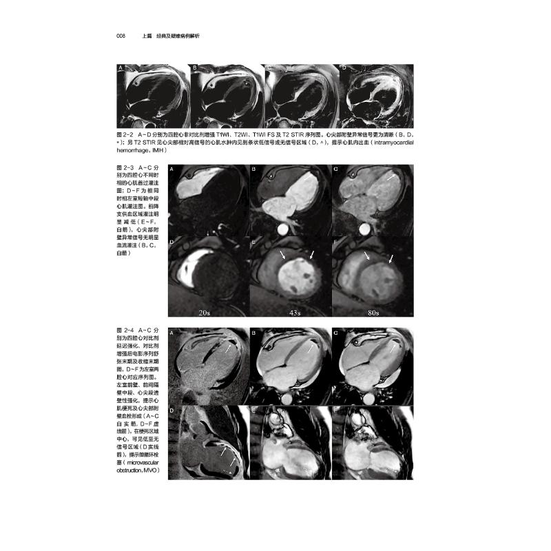 【新华文轩】心血管磁共振 病例解析与临床实践 正版书籍 新华书店旗舰店文轩官网 中国医药科技出版社