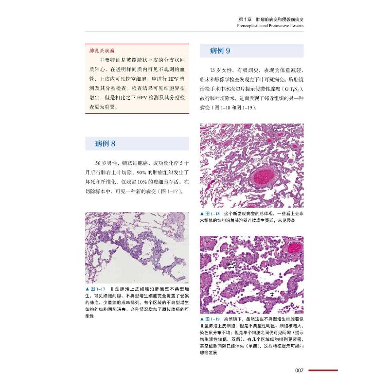 【新华文轩】肺病理诊断图谱 (奥)赫尔穆特·H.波普尔,(意)布鲁诺·穆勒 正版书籍 新华书店旗舰店文轩官网 中国科学技术出版社 - 图1