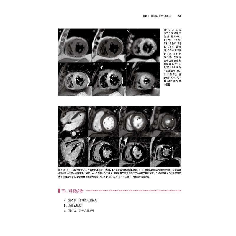 【新华文轩】心血管磁共振 病例解析与临床实践 正版书籍 新华书店旗舰店文轩官网 中国医药科技出版社