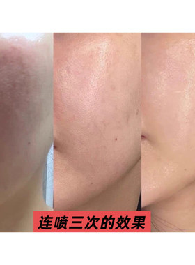 高透皮吸收 三型+17XVII胶原水光舒缓灌注喷雾 强制补水敏感修复