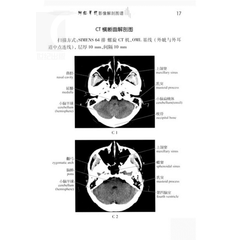 神经系统影像解剖图谱/医学影像学解剖图谱丛书李克入门读物西医医学医药卫生上海科技世纪出版-图3