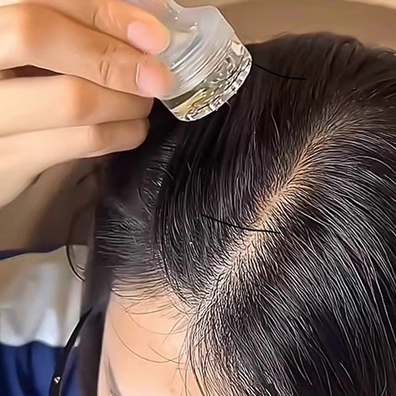 米诺头皮上药器头部按摩滚珠导液梳健发头发精华育发导梳涂抹神器,淘宝优惠券,粉丝福利购,淘宝优惠卷