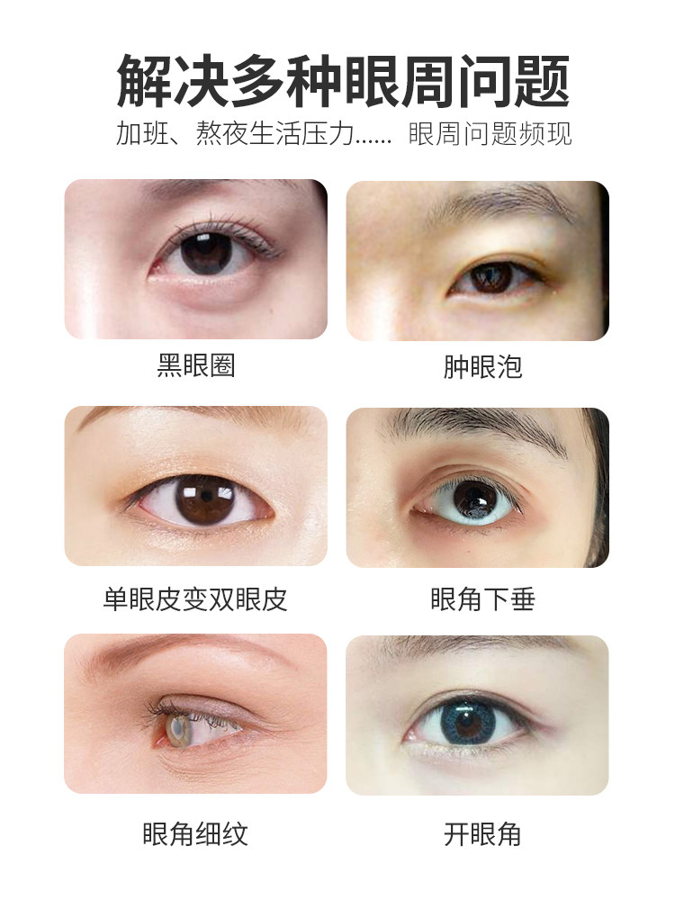 第2代扩眼精油女扩眼精华精华液 柏卡姿宅尚单方精油