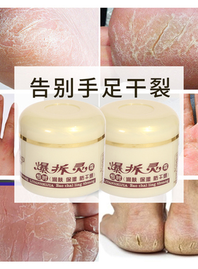 爆拆灵防干裂护手霜涂脚后跟