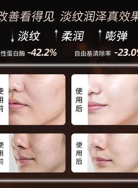 圣雪兰御龄紧致抗皱贴片面膜补水保湿淡化细纹提拉熬夜正品旗舰店