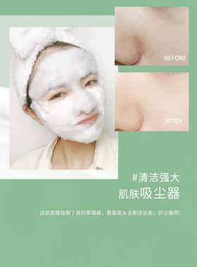 微酸积雪草小气泡面膜黑头收缩毛孔水杨酸自发泡清洁泥膜女