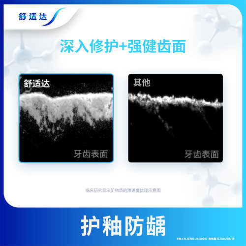 舒适达多效护理抗敏感牙膏180g防蛀健齿缓解牙敏感清洁口腔护龈 - 图1