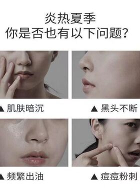 雪玲妃氨基酸洗面奶清洁毛孔控油补水温和官方正品洁面男女学生