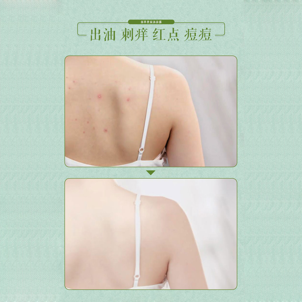 佰草世家旗舰店佰草世家草本沐浴露女男士全身补水持久留香后背去痘除螨送美白膜1