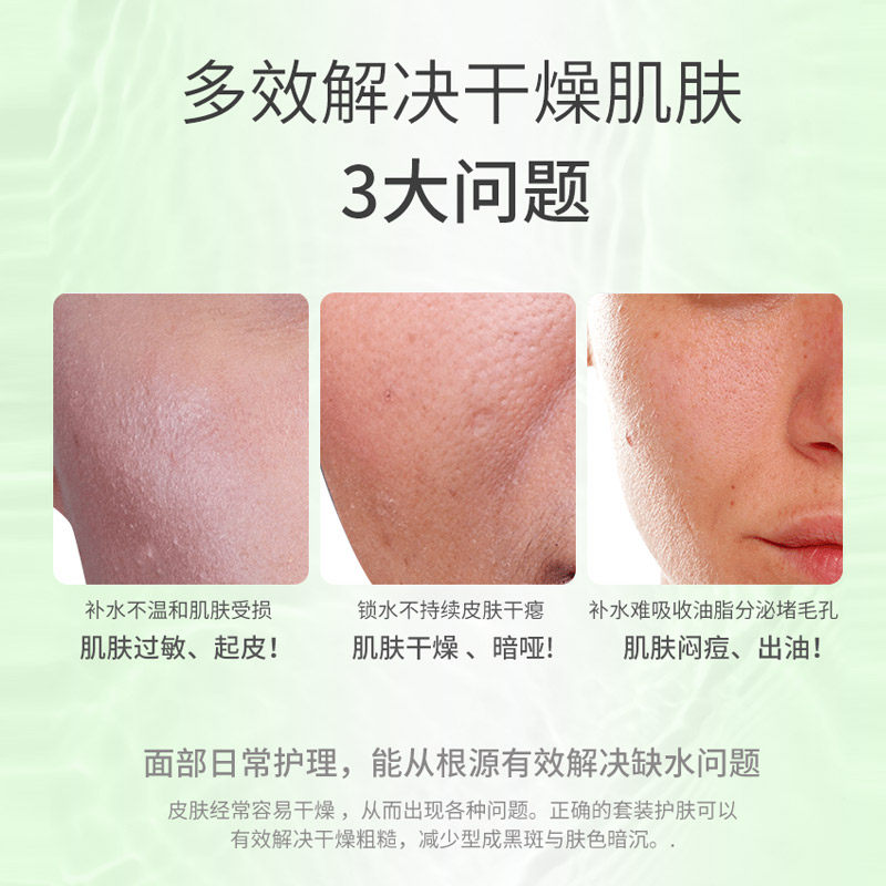 雪完美补水套装男女组合清爽植物 雪完美化妆品面部护理套装