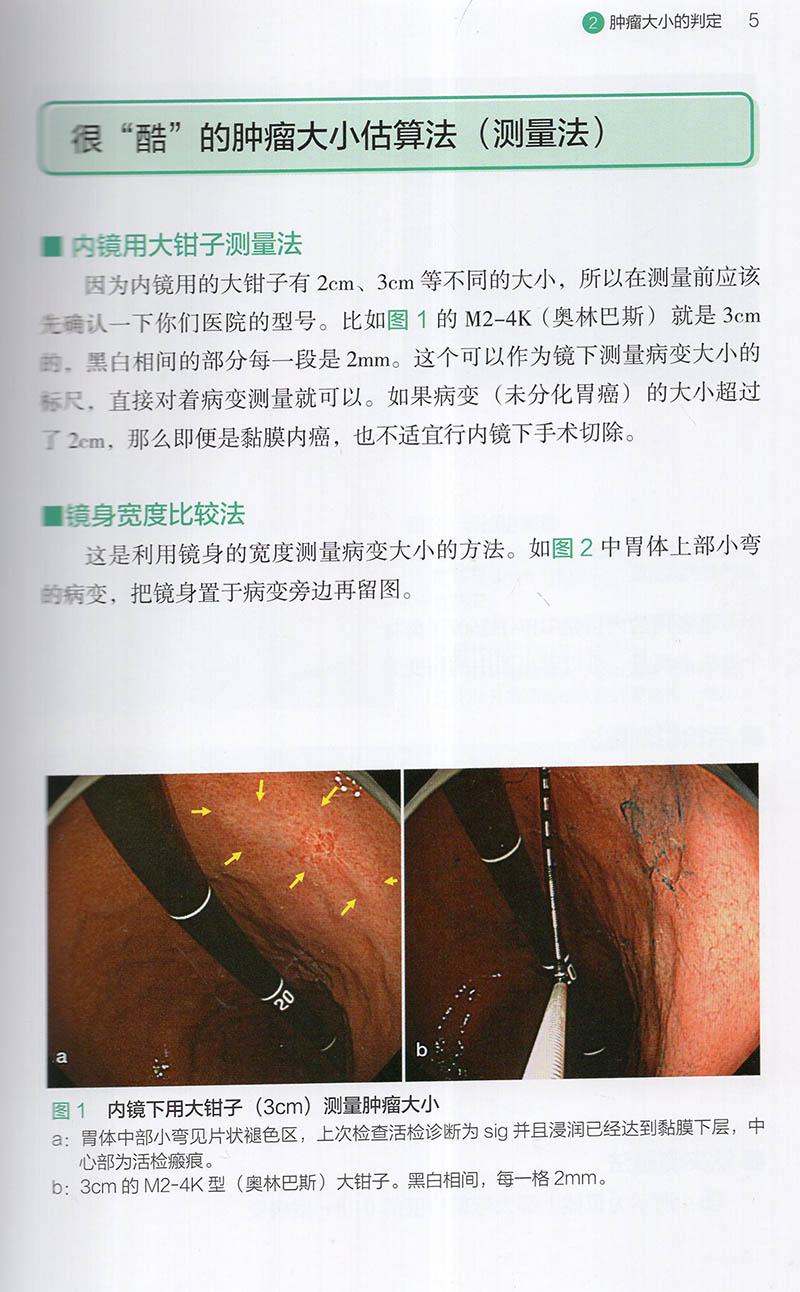 现货速发上消化道内镜诊断秘籍日野中康一食管表浅癌Barrett食管腺癌胃溃疡早期胃癌鉴别诊断书籍内镜诊断与鉴别诊断图谱手术操作