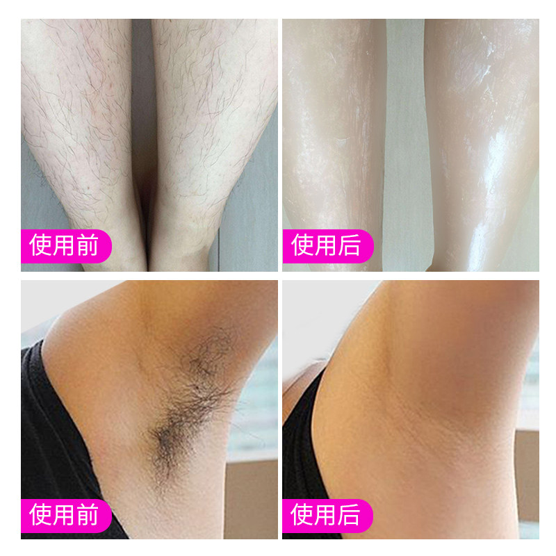 女学生持久去腋毛腿毛手臂男脱毛膏 爱肤宜妮希娅脱毛膏